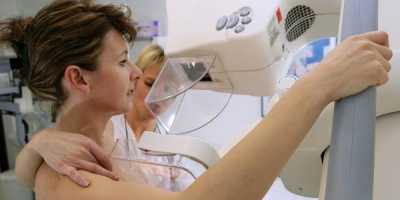 Mi a mammográfia és hogyan történik